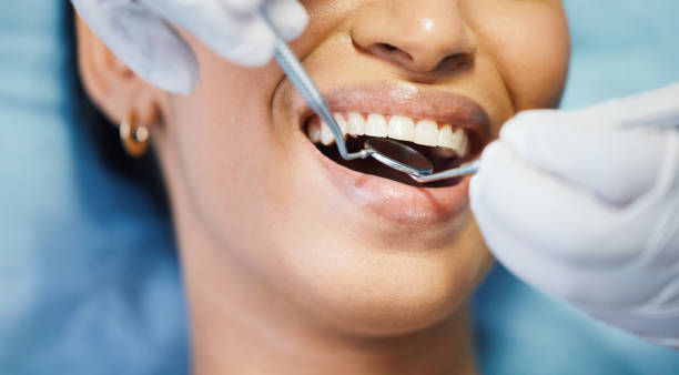 Best Weekend Emergency Dentist in Upper Sandusky, OH